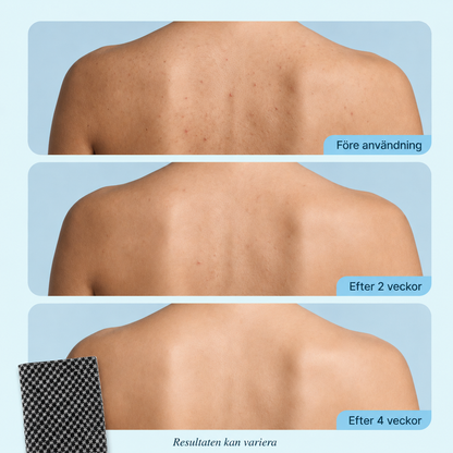 SilkeScrub™ – Exfolierande badhandduk för silkeslen hud.