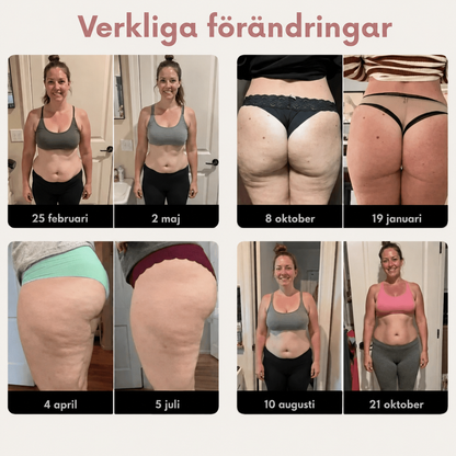 SculptLegging™ | Leggings som arbetar aktivt mot celluliter