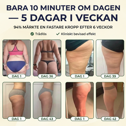 CelluliteElite – Slätare och fastare hud utan klinikbesök